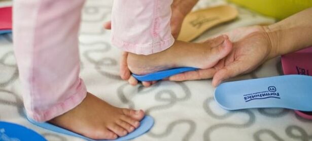Valgus insoles deformation of the foot in children