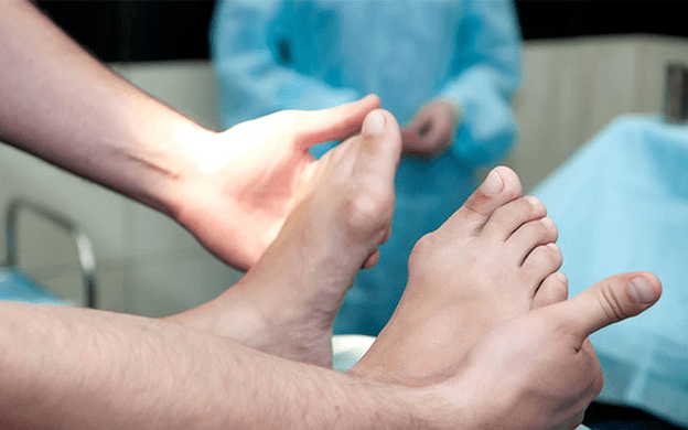 Valgus deformation of the foot